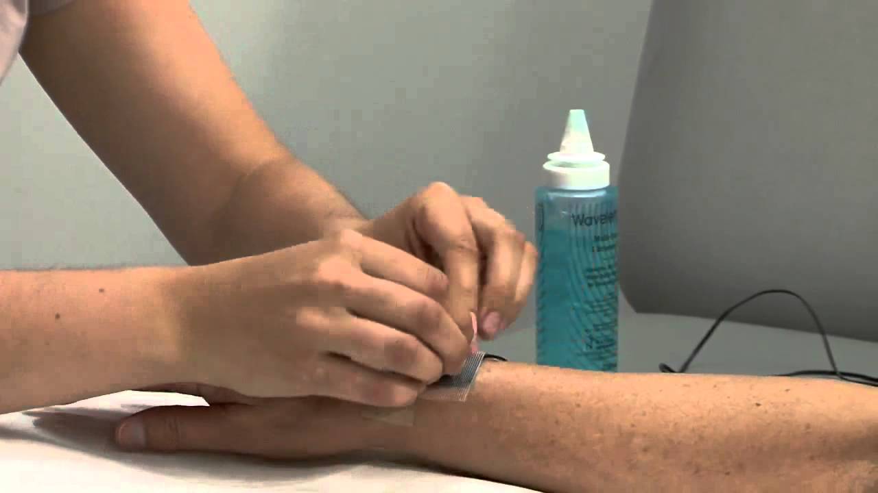 Neurostimulation électrique transcutanée pour l'arthrite rhumatoïde (Séance pratique)