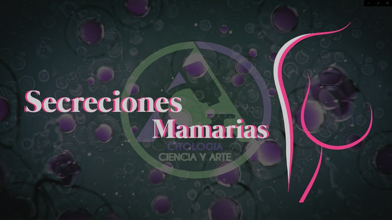 Secreciones mamarias