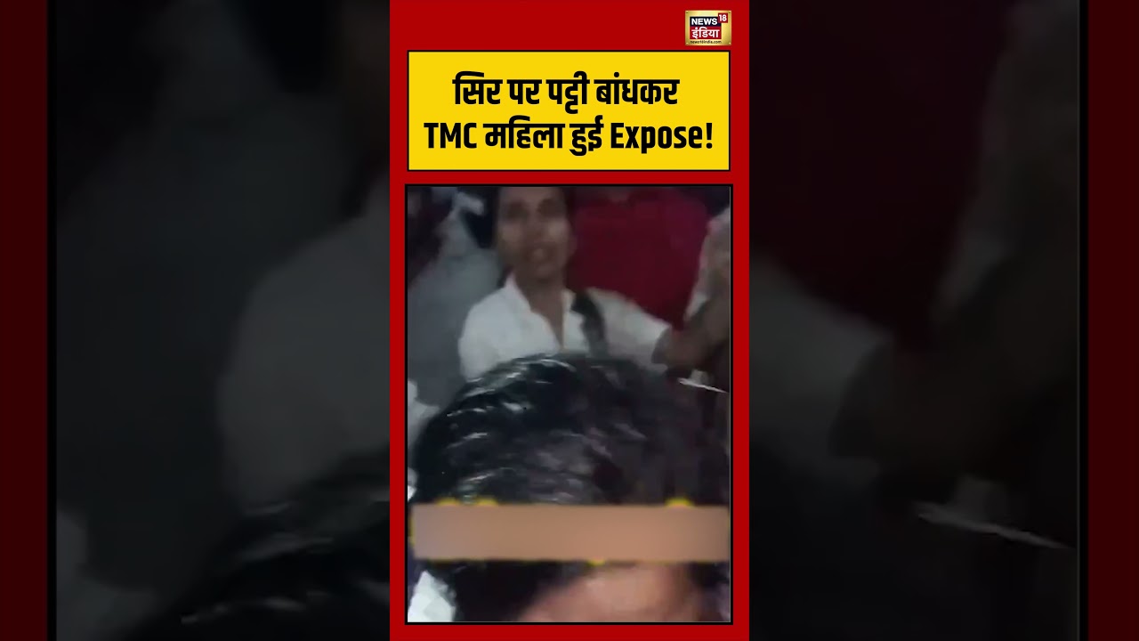 सिर पर पट्टी बांधकर TMC महिला हुई Expose! | #viralnews #viralvideo #shortvideo #shortsfeed