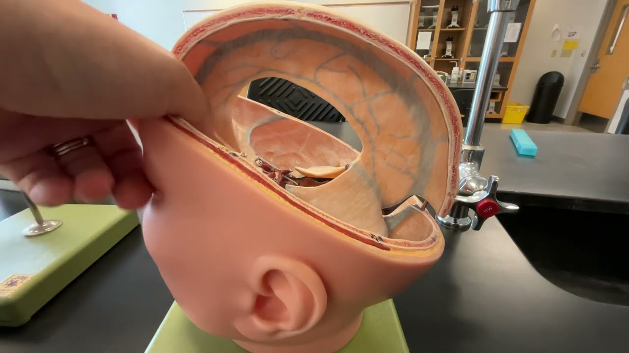 Lab 18: Dural Septa and Dural Venous Sinuses