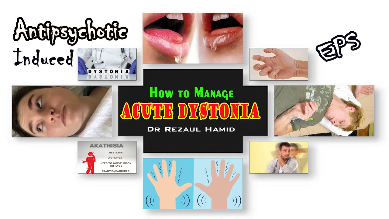 Acute Dystonia - Causes & Management @Dr Rezaul Hamid