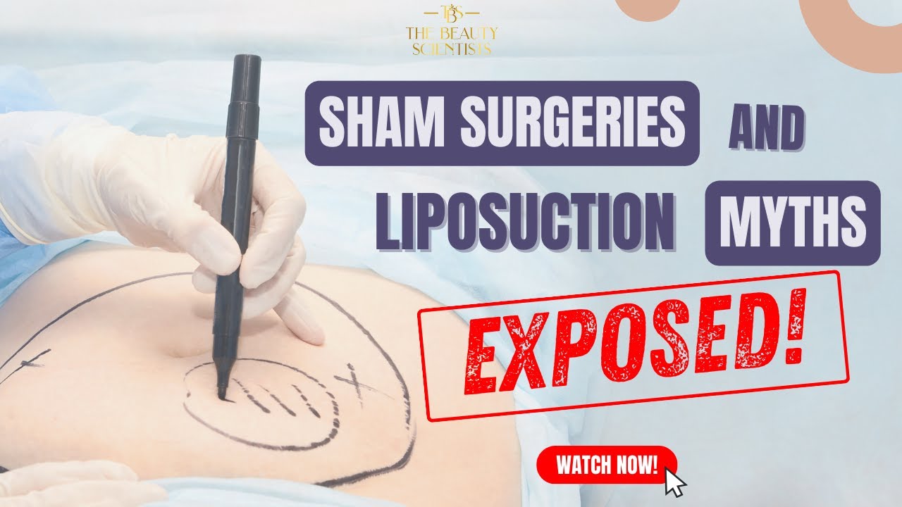 Sham Surgeries and Liposuction Myths Exposed! What You Need to Know