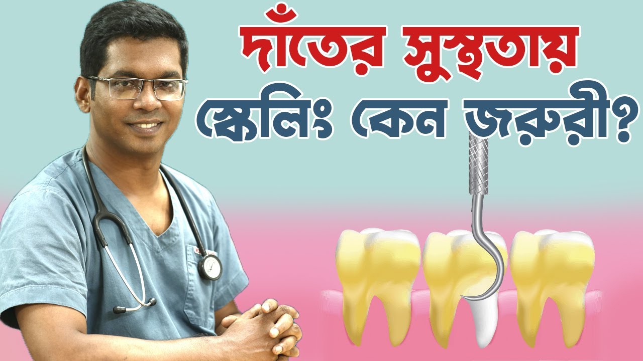 দাতের সুস্থতায় স্কেলিং কি জরুরী?  স্কেলিং কখন করবেন? জেনে নিন ডাঃ সাকলায়েন এর চায়ের আড্ডা থেকে