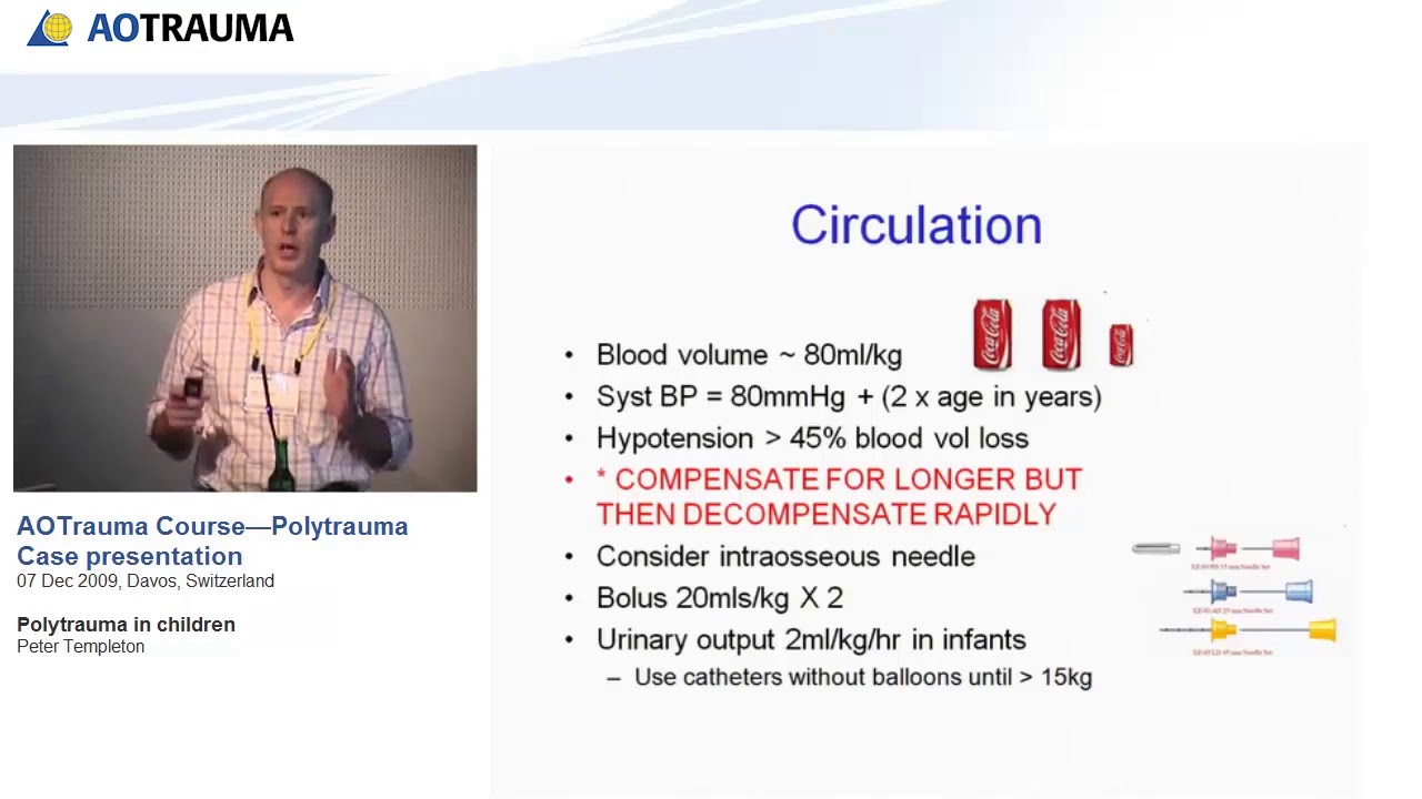 Polytrauma in children