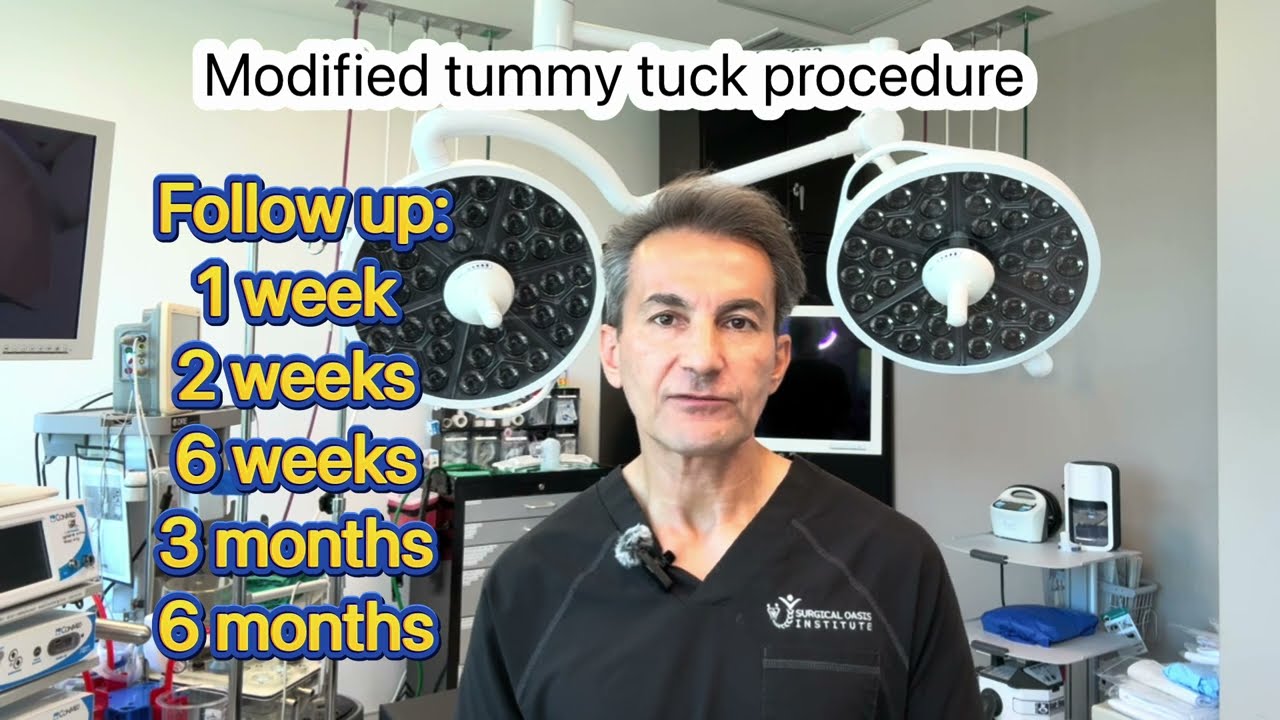 Recovery after modified tummy tuck surgery by Dr. Iraniha
