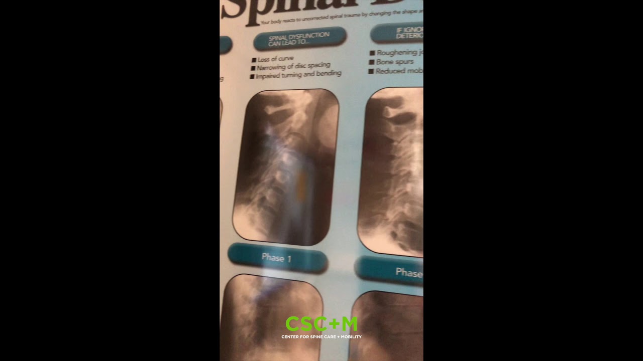 Chiropractic X-Rays: Midtown NYC Chiropractor Explains X-Rays at CSC+M