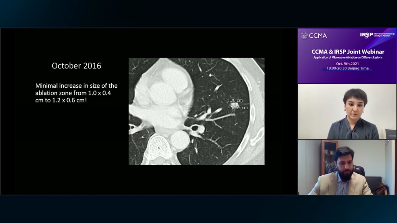 Dr. Zahid Amin Khan - Thermal Ablation of Lung Lesions- From the Simple to the Complex