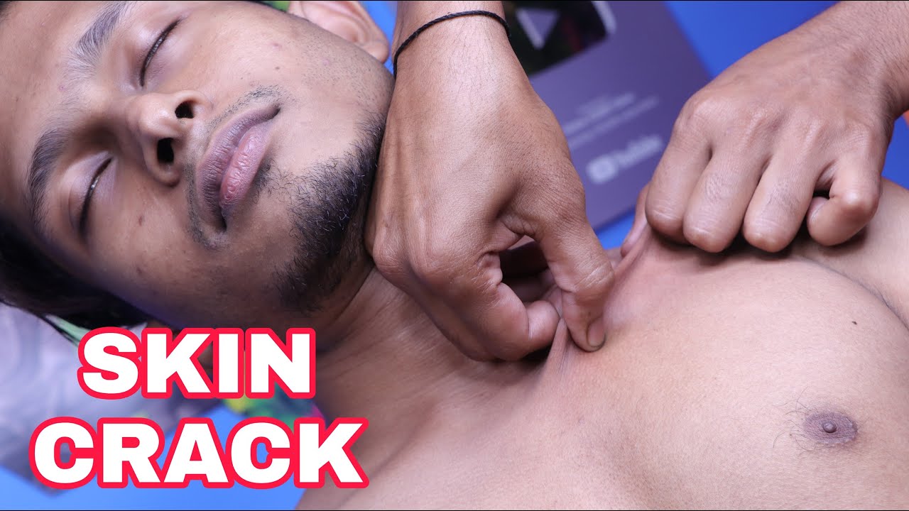 ASMR Chest skin and back skin crack | head body massage with skin and neck crack | relaxing triggers