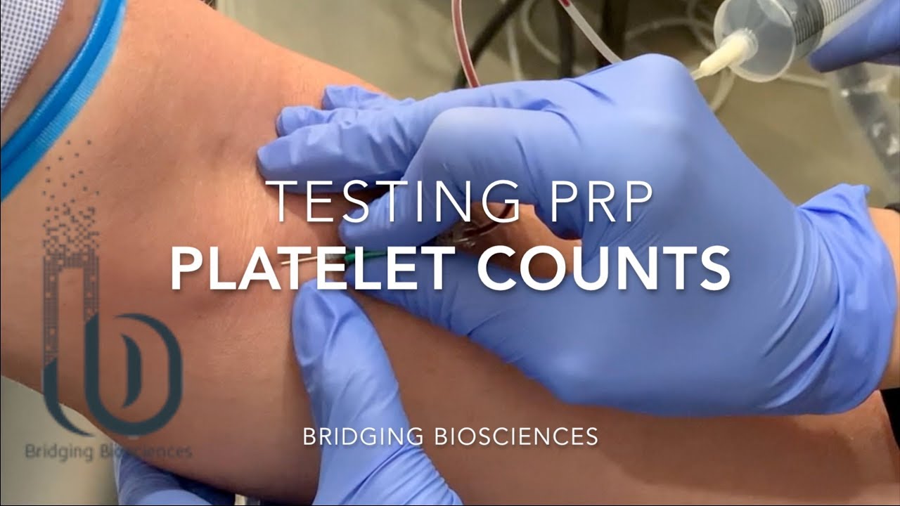 Do you know what the Platelet Count is in your PRP?