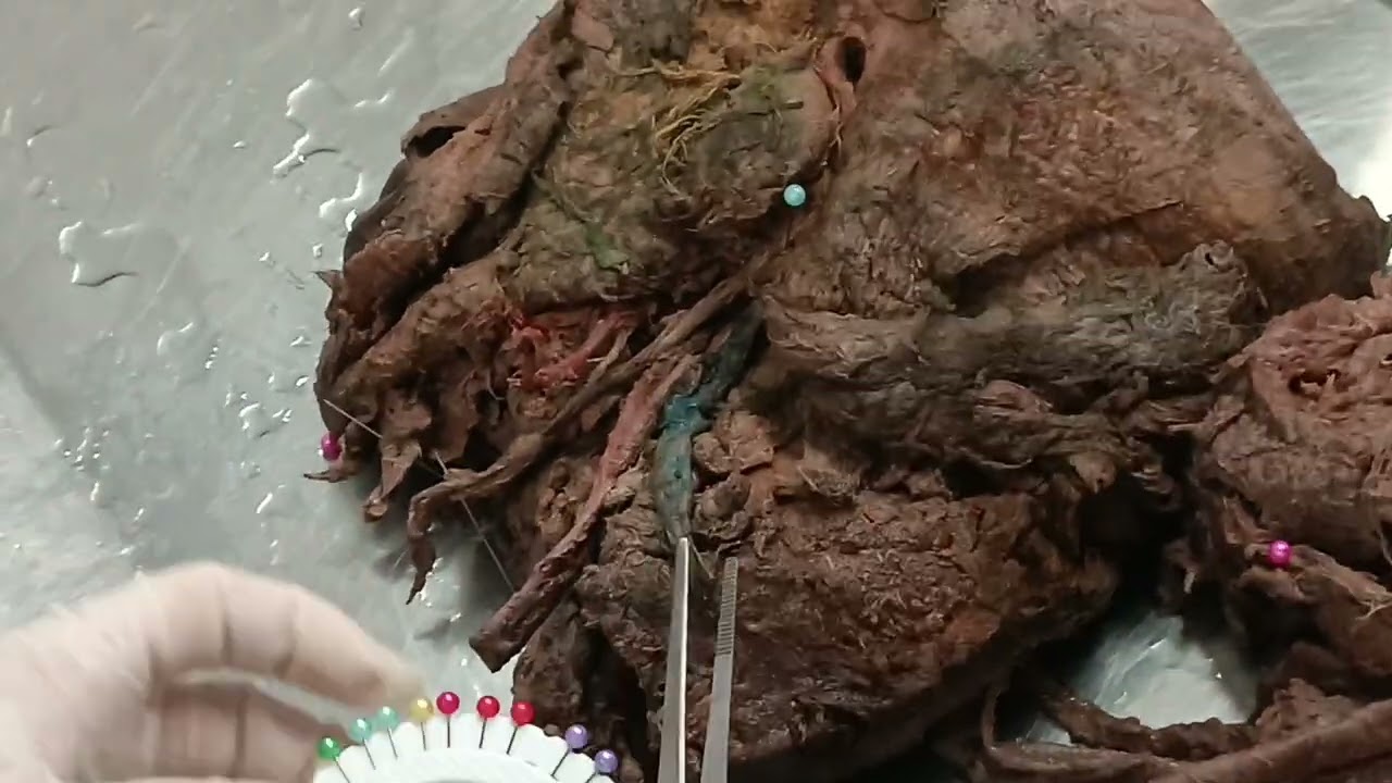 Triangulo digastrico 