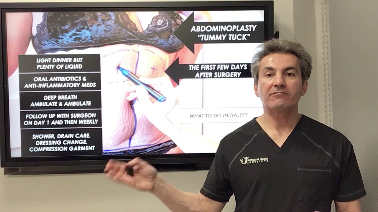 What to expect after tummy tuck surgery by Dr. Iraniha