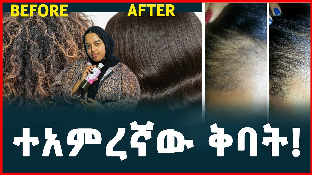 የፀጉር መነቃቀልን የሚያቆም እና ፀጉርን የሚያበዛ ድንቅ ቅባት | Natural Hair Oil | Tirita Podcast