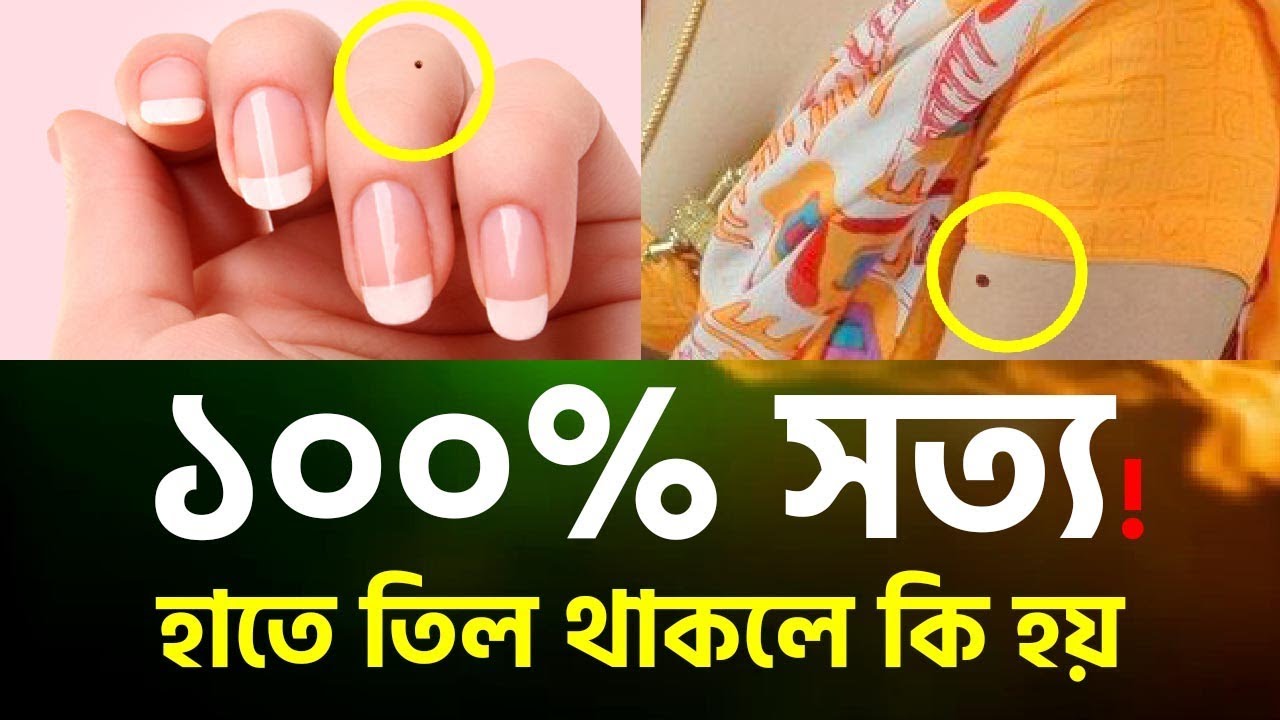 হাতে তিল থাকলে কি হয় ? ● শরীরের কোথায় তিল থাকলে কি হয় ?