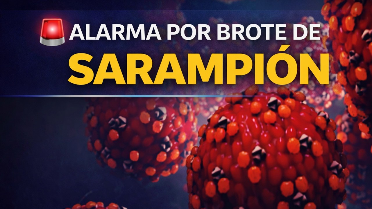 Brote de sarampión: virus puede vivir 2 horas en el aire y contagia rápidamente