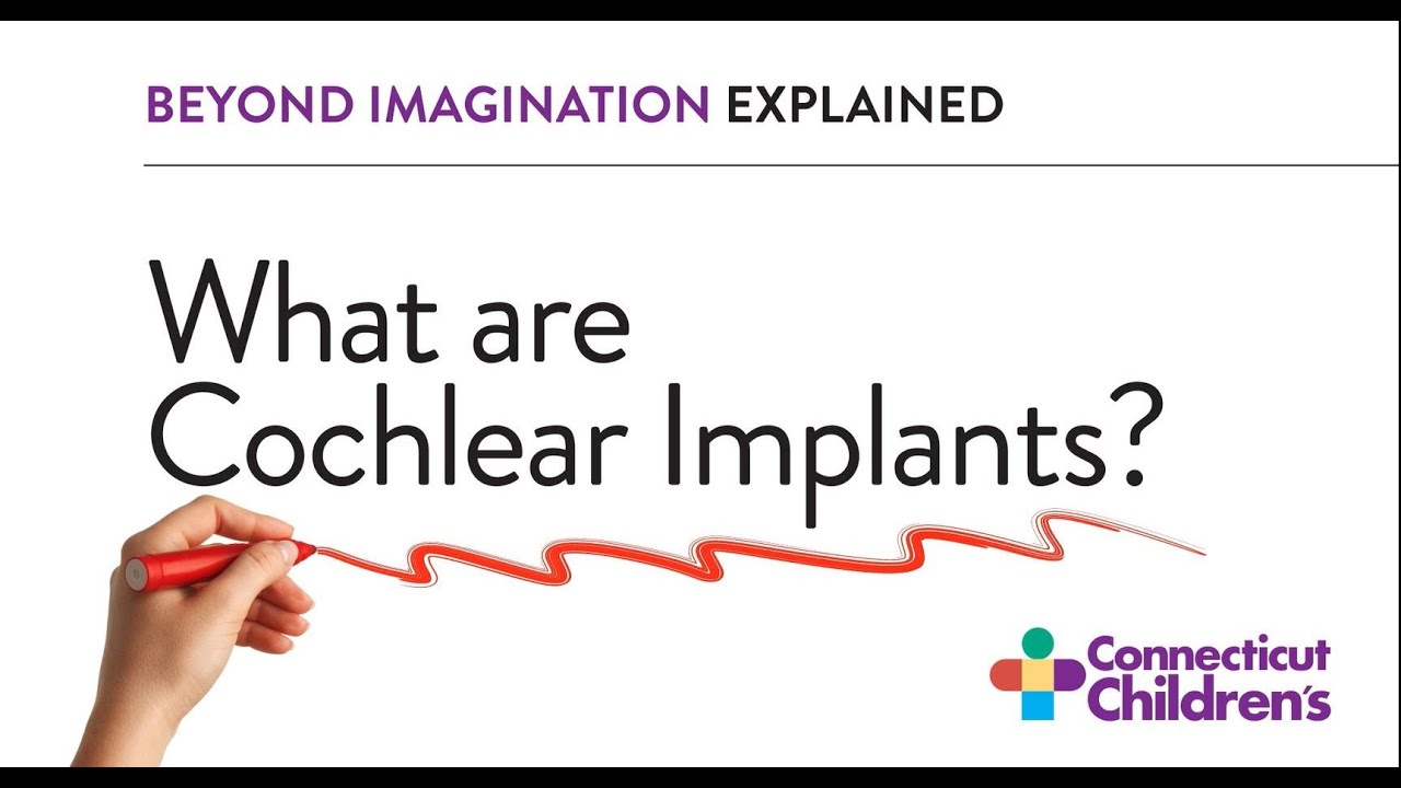 What Are Cochlear Implants? | Connecticut Children's