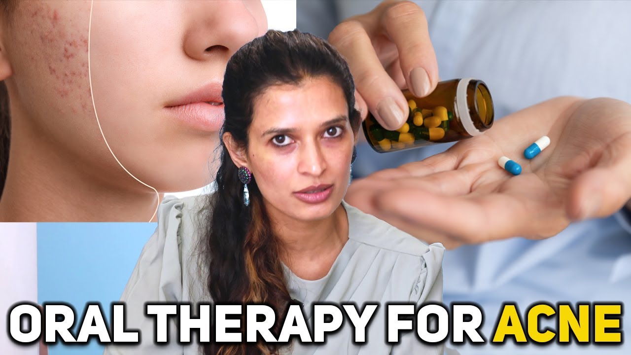 Oral Therapy for Acne - Your Comprehensive Guide to Clear Skin Dr. Shlipa Drama Elite
