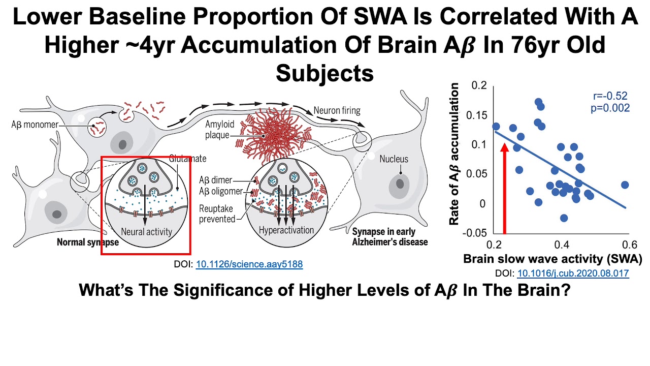 Deep Sleep: How Does It Change During Aging, What's Its Connection To Alzheimer's Disease?