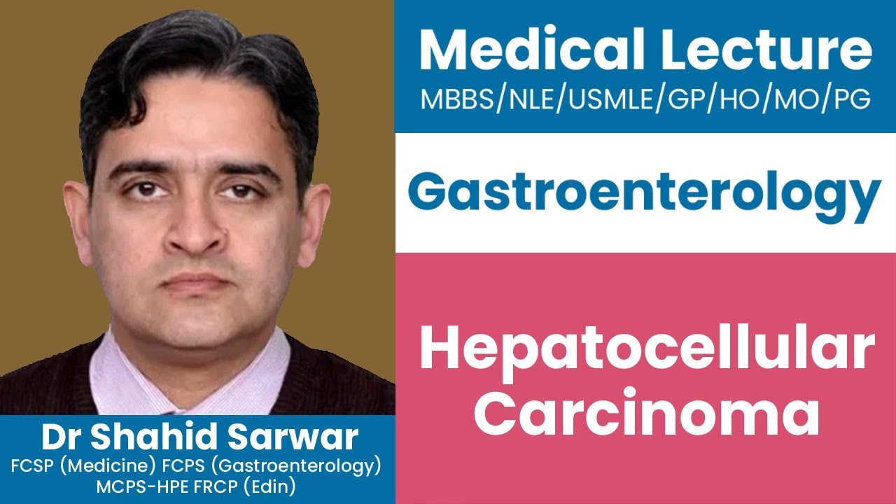 Hepatocellular Carcinoma (HCC) | Professor Shahid Sarwar