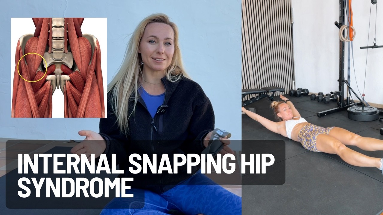 THE EXERCISES THAT FIXED MY HIP SNAPPING SYNDROME (Part 1 of 2) (Internal Snapping Hip Syndrome)