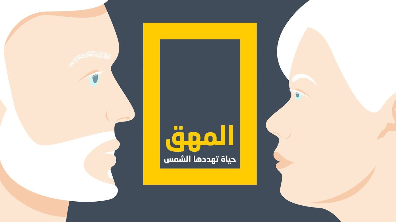 المهق.. حياة تهددها الشمس