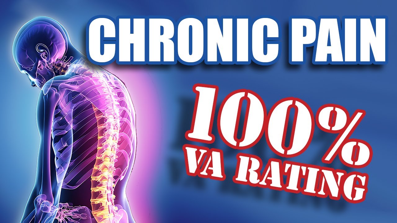 Как получить 100% рейтинг VA при хронической боли!