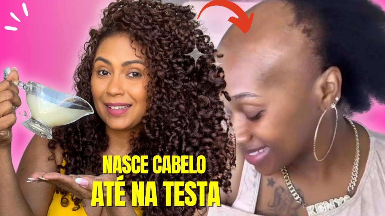 O cabelo cresce loucamente e não cai! 3 ingredientes poderosos para o crescimento EXTREMO do cabelo!