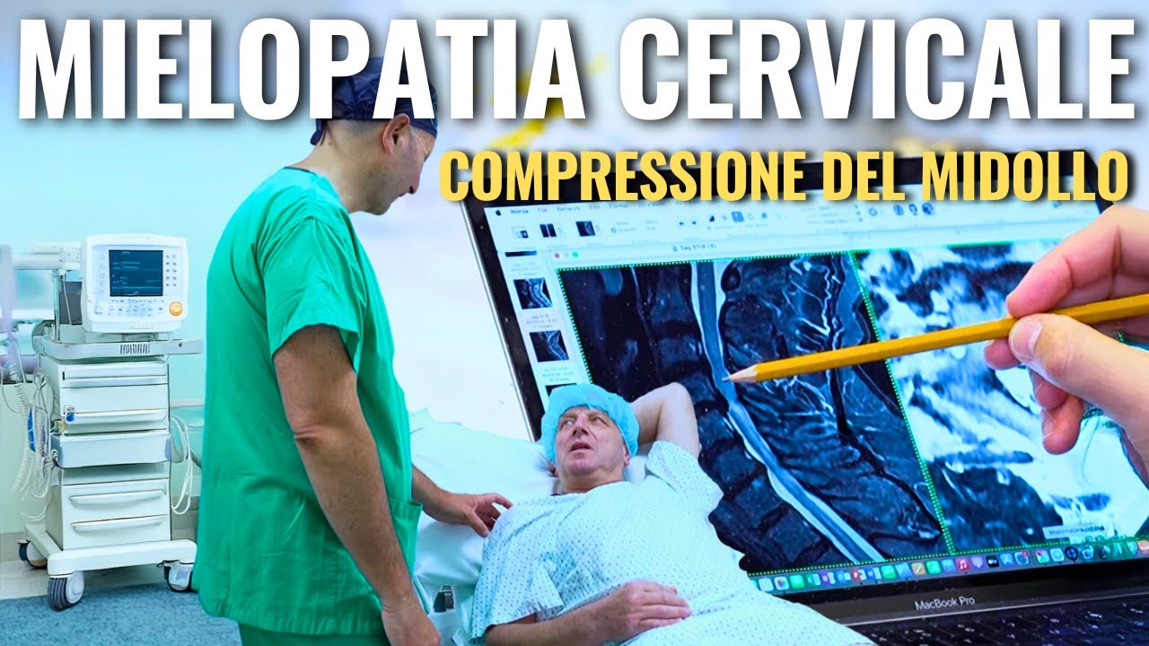 Sofferenza del Midollo: Cos'è la Mielopatia Cervicale? | Cause, Sintomi e Come Risolverla
