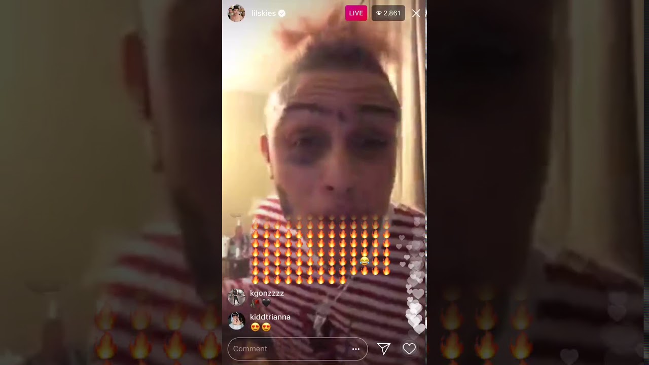 Lil Skies *Lit* Ig Performance 🔥