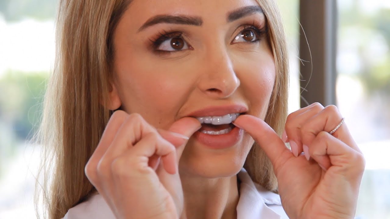 Should I Wear a Dental Night Guard?