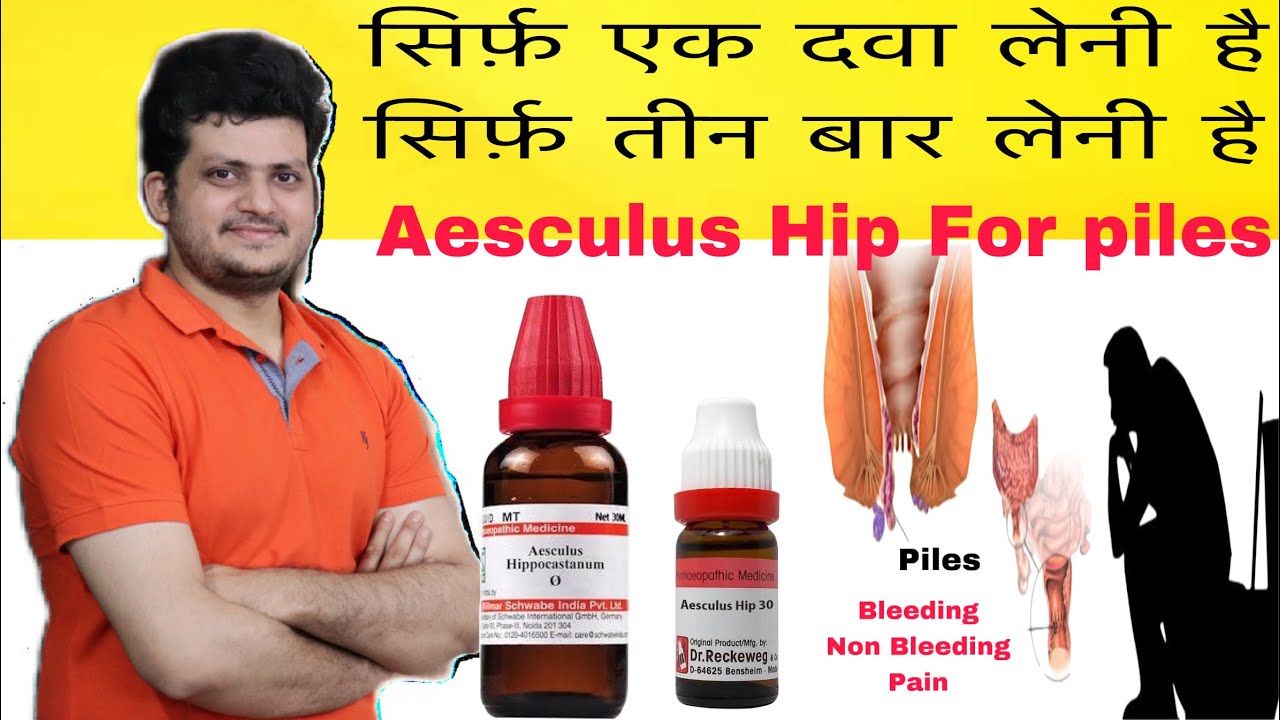 Aesculus Powerful Homeopathic Medicine for Piles | 100% effective | symptoms | How to use |