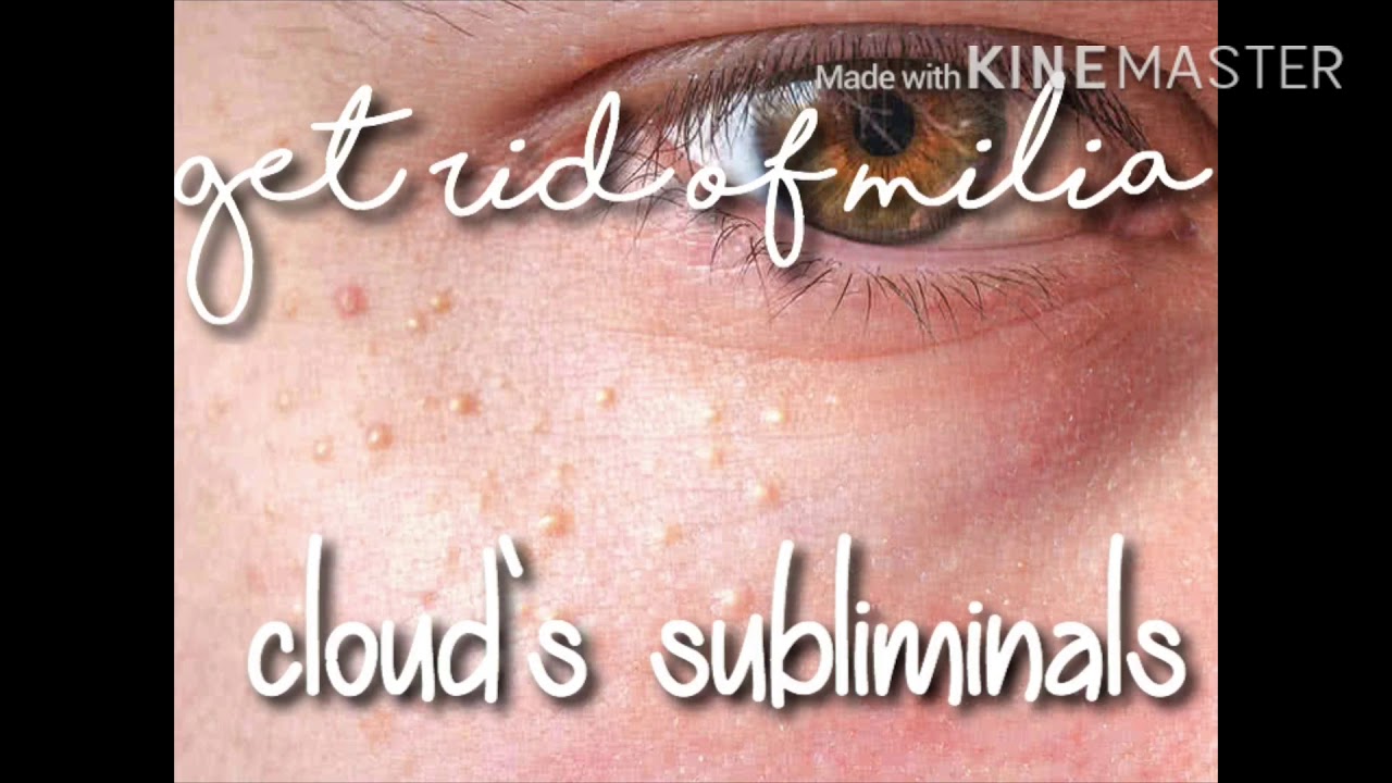 ❧ get rid of milia subliminal ☙