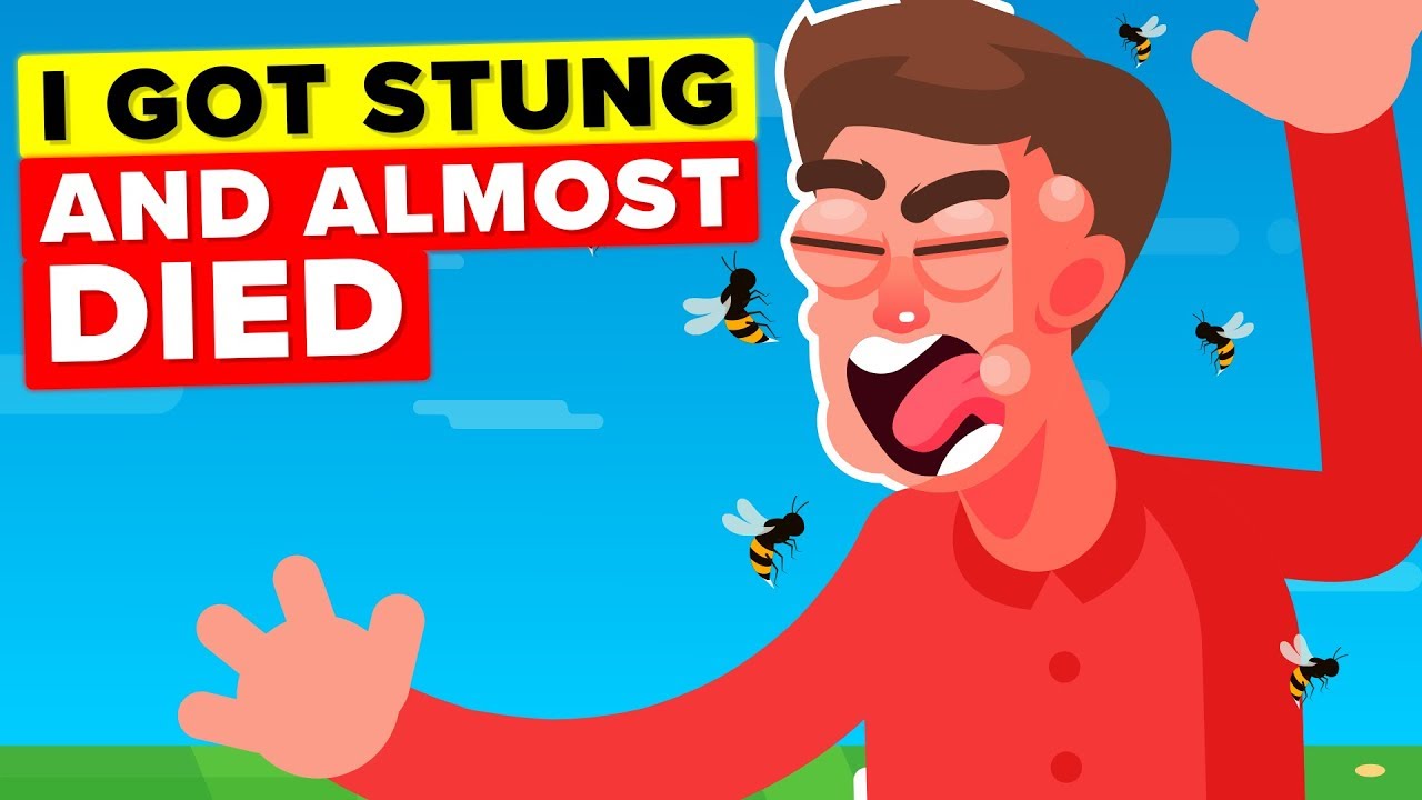 I Got Stung 50 Times By Bees & I'm Allergic - Story