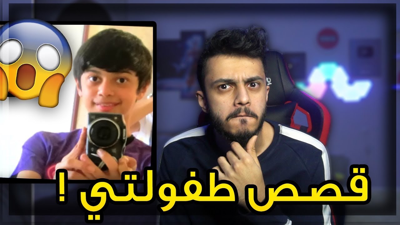 اقوى حادث صارلي وانا صغير !| قصص طفولتي