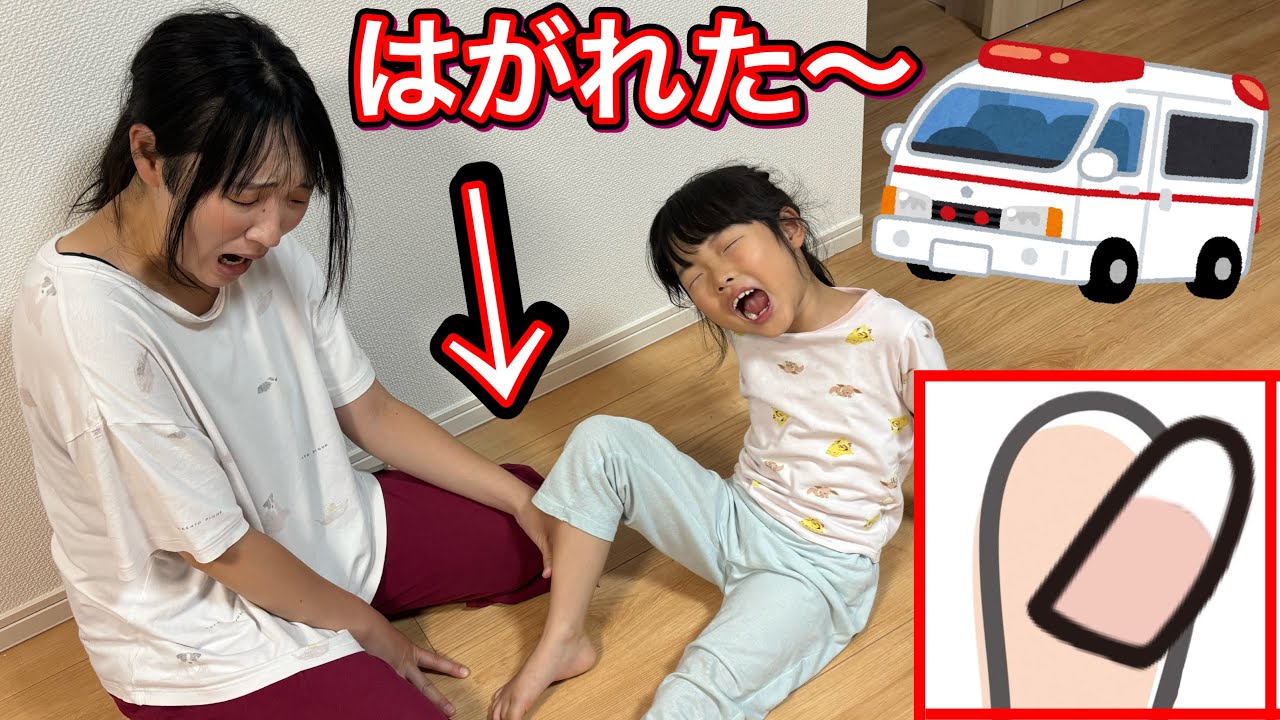 救急車呼んで〜爪はがれて大変〜ここちゃん突然泣き出してまさかの………😭【実話再現】