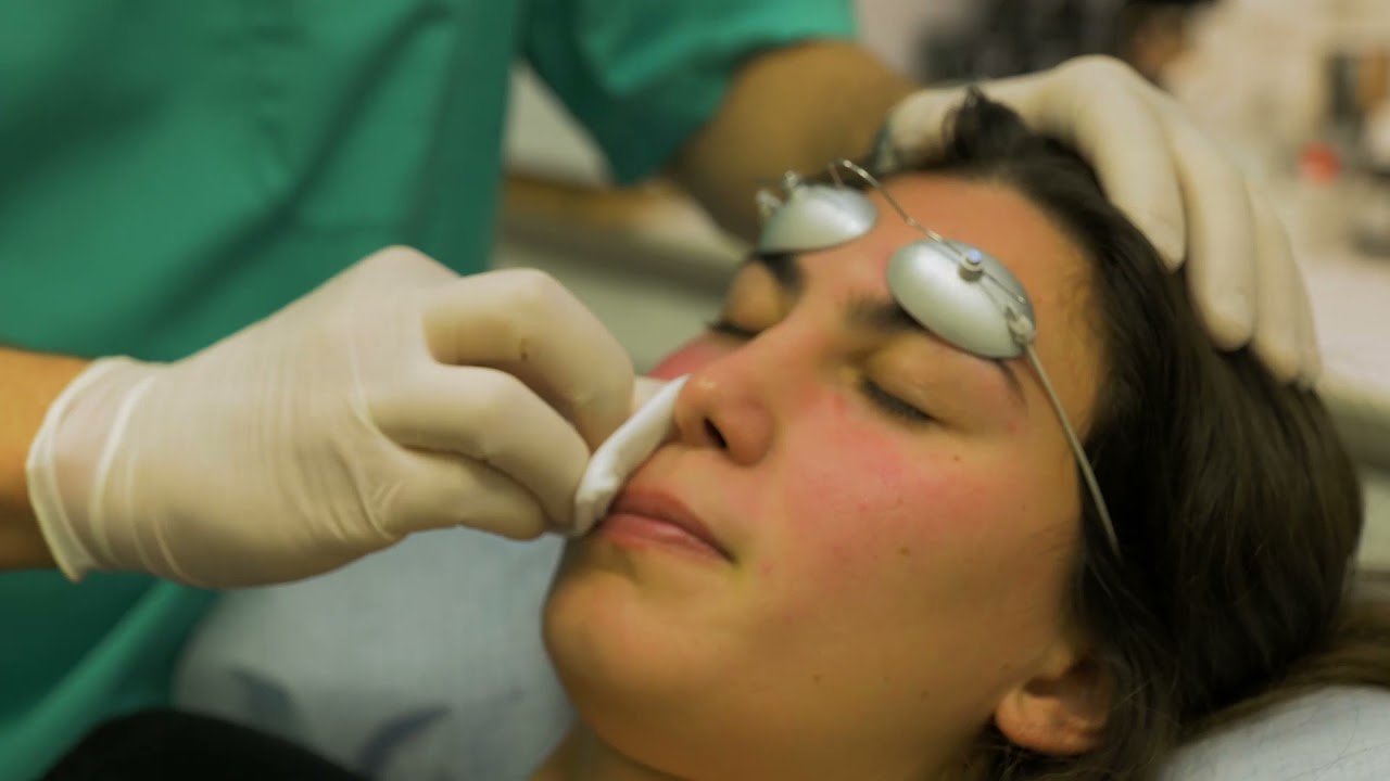 Dr. Trincheiras enseña los pasos y parámetros para un tratamiento de rosáceas con colorante pulsado