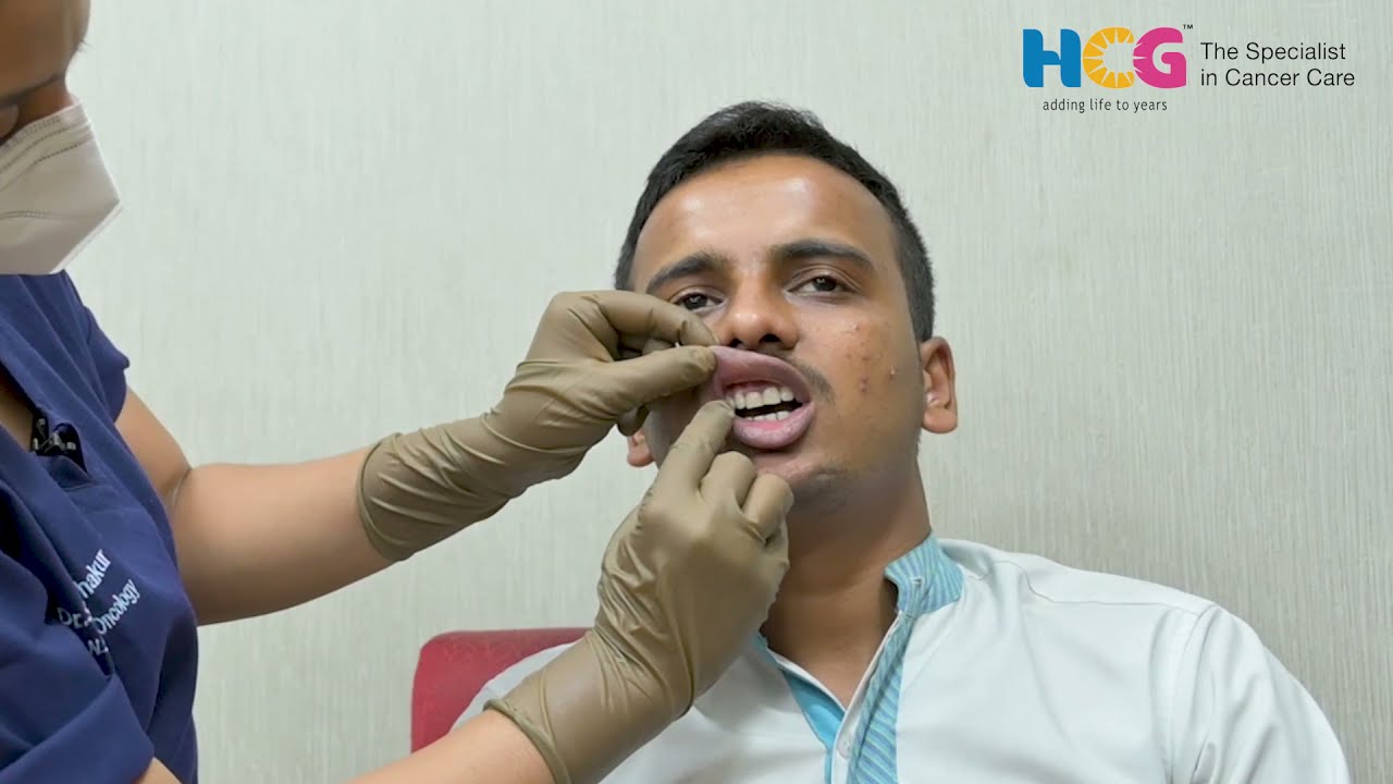 Oral Cancer Screening Easy Steps | मुँह का कैंसर कैसे होता है ?| Mouth cancer symptoms in Hindi