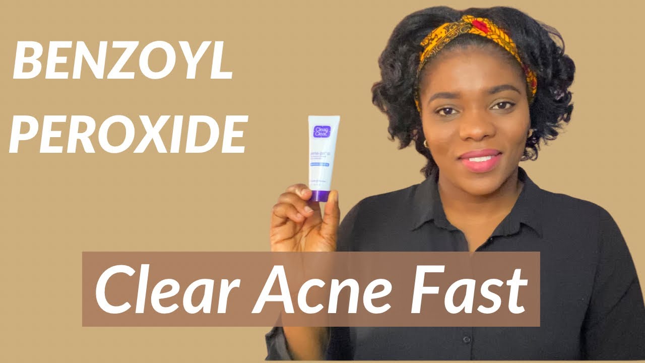Acne Treatment - How to use BENZOYL PEROXIDE for ACNE | Dr Janet