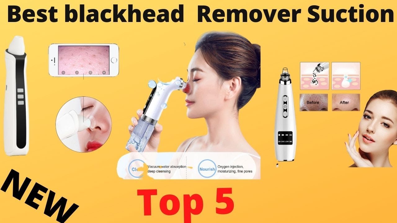 Top 5 best blackhead remover Vacuum Suction = you can buy right now