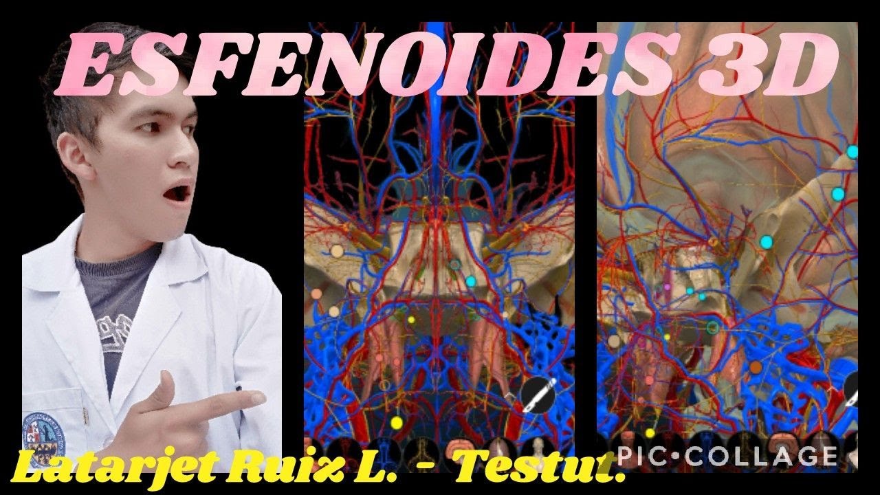 3D Anatomía | HUESO ESFENOIDES (PARTES, CARAS, BORDES, INSERCIONES, NERVIOS, ARTERIAS, AGUJEROS)