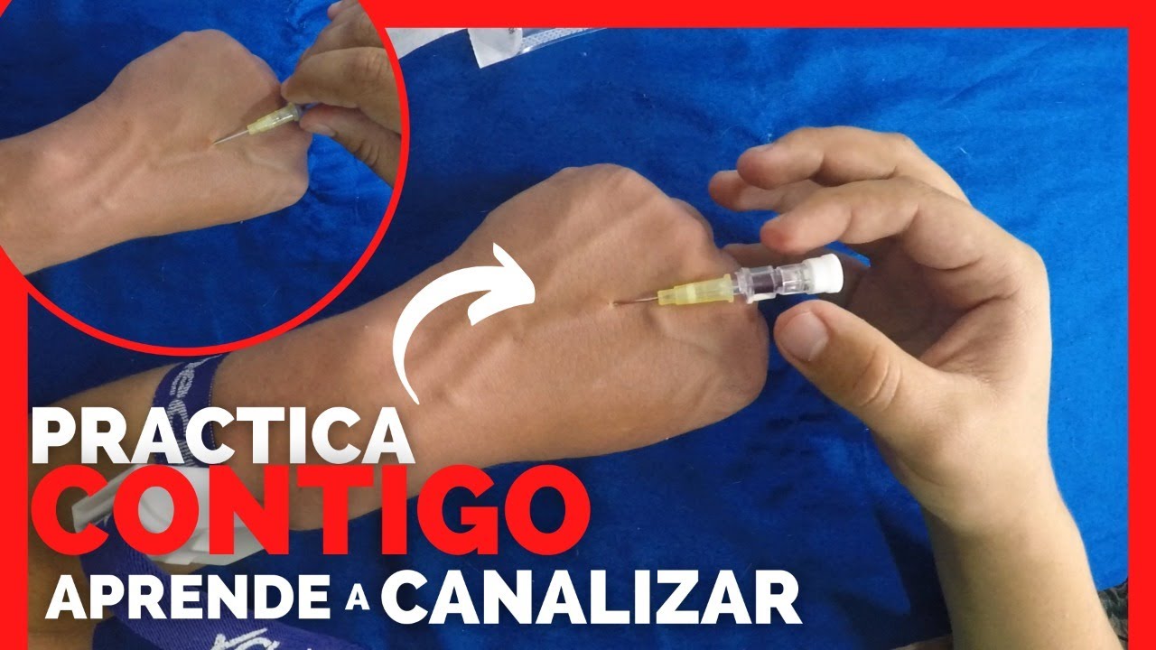 ✅TIPS PARA CANALIZAR UNA VENA A LA PRIMERA | Practica CONTIGO MISMO | ENFERMERIA