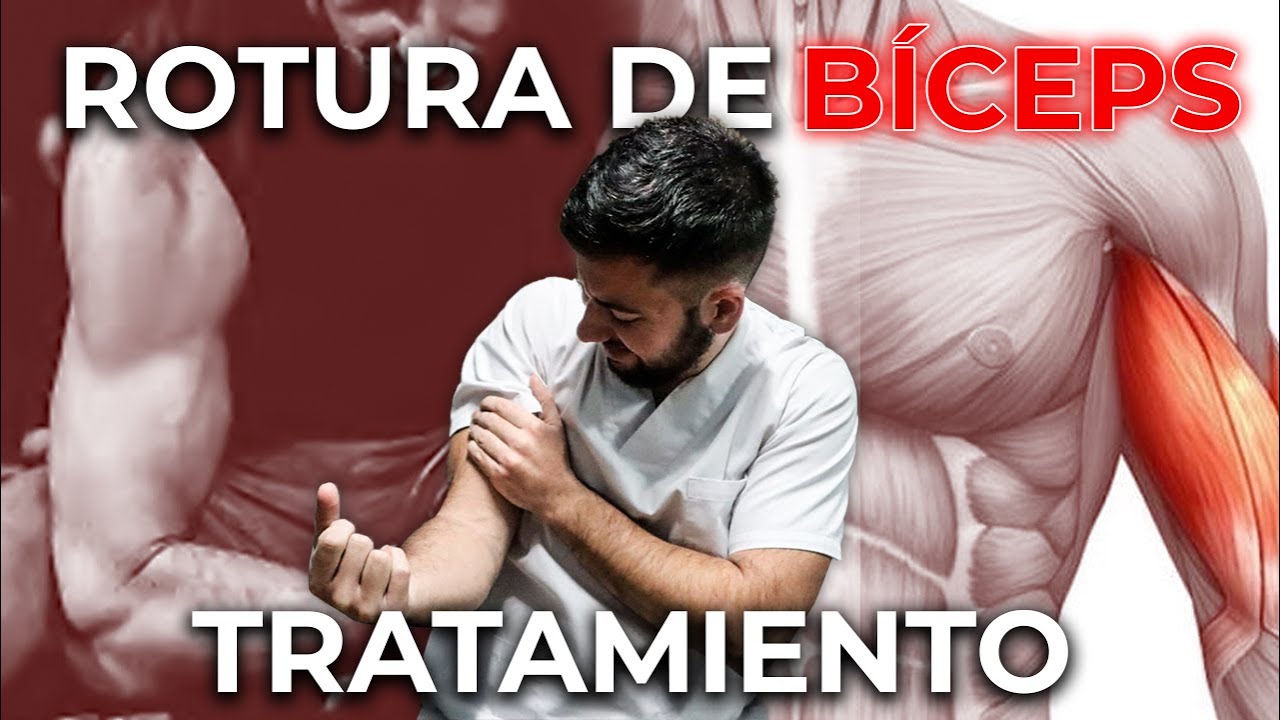 TRATAMIENTO de la ROTURA del tendón del bíceps 🤕 - Opinión de Fisioterapeuta