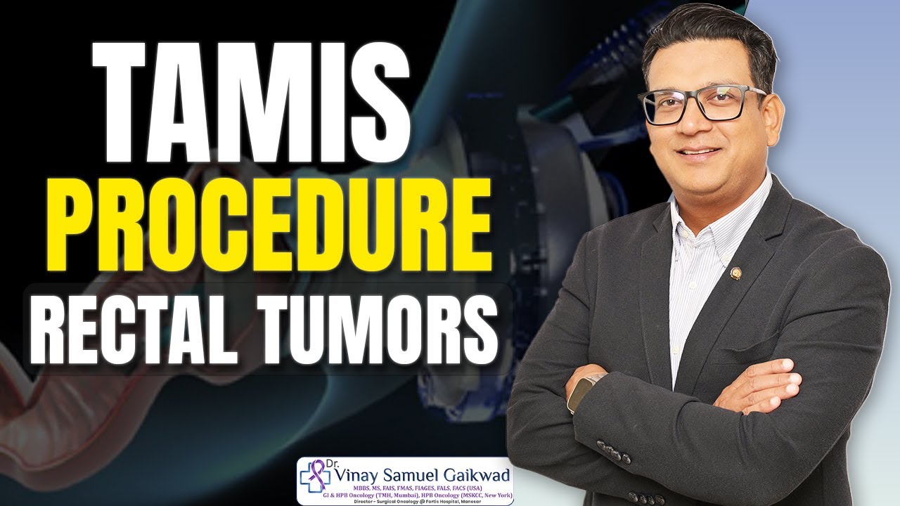 TAMIS Procedure: Invasive Approach for Rectal Tumors | Dr Vinay Samuel Gaikwad #rectal #tumors