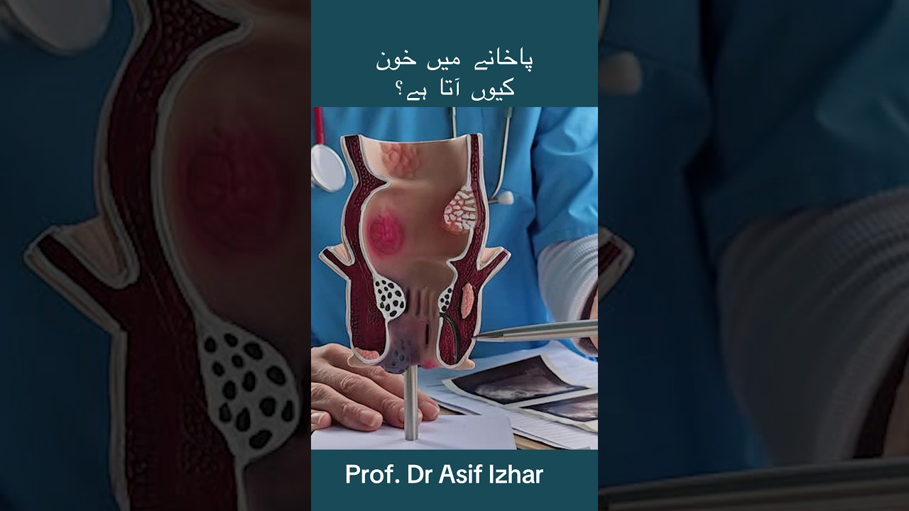 pakhane me khoon aane ki wajah #constipation #hemorrhoids #healthtips #drasifizhar