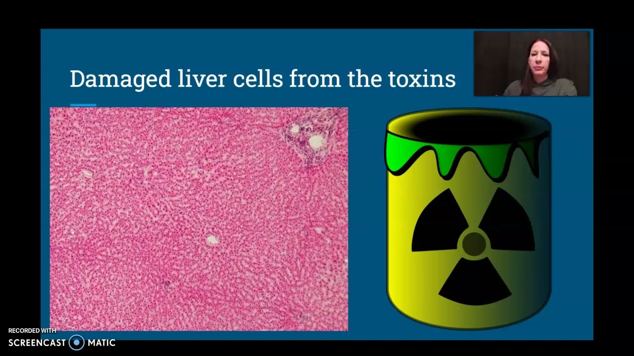 Microcystic Toxins