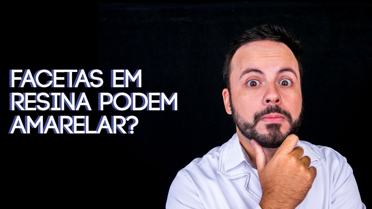 As FACETAS EM RESINA podem amarelar? Como posso clarear? #drrowanvilar