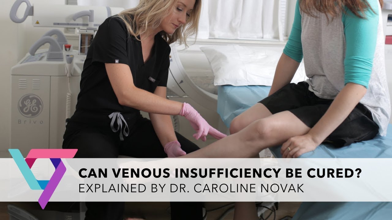 Medical Clinic: Can Venous Insufficiency Be Cured? | Vein Treatment Clinic New York 10016