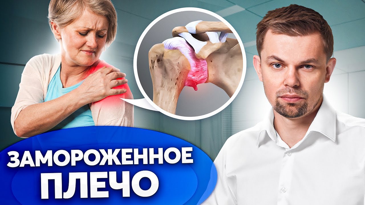 Опасная БОЛЬ в ПЛЕЧЕ! Правильное лечение адгезивного капсулита