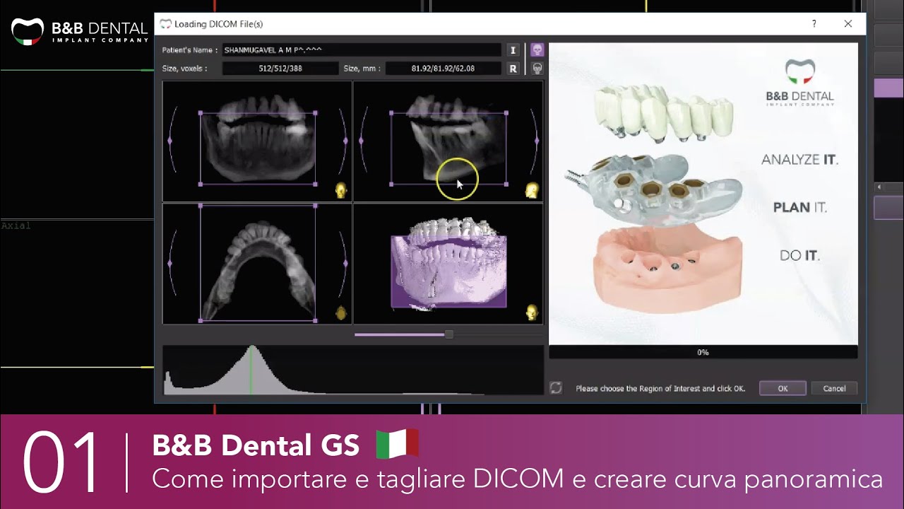 B&B Dental GS - 01 - Come importare e tagliare DICOM e creare curva panoramica