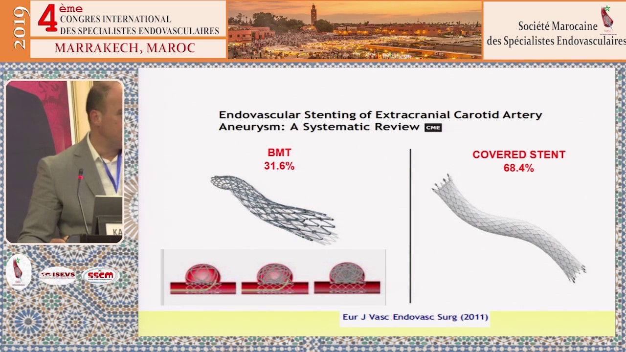 Traitement Endovasculaire d’un faux anévrysme carotidien