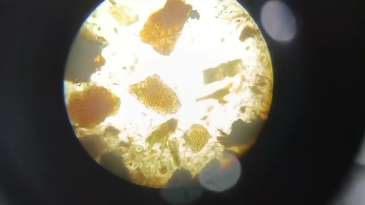 Microscopic Identification of Caraway Powder (Crude Drug)